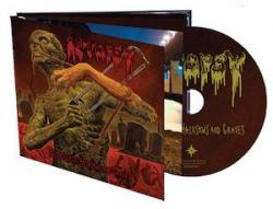 AUTOPSY - TOURNIQUETS, HACKSAWS AND GRAVES LTD. EDIT. (DIGI-BOOK)